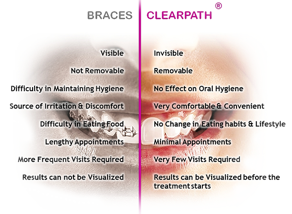 Clear Braces  Invisible Braces  ClearPath Orthodontics